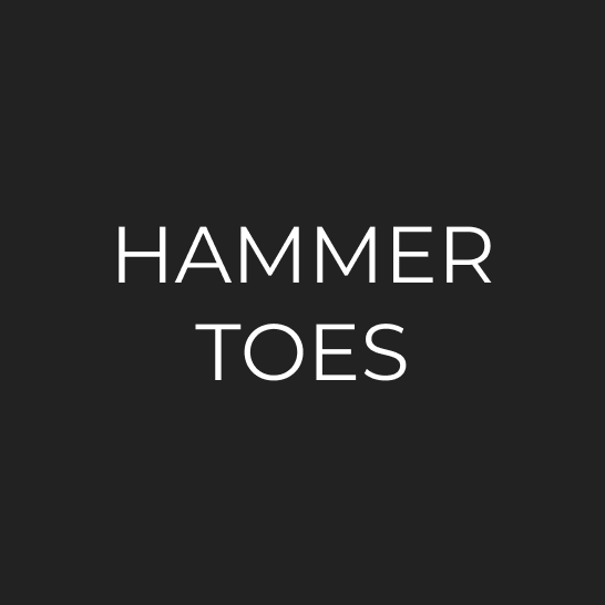 Hammer Toes